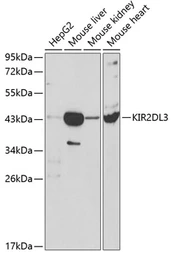 Anti-KIR2DL3 antibody used in Western Blot (WB). GTX54367