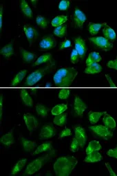 Anti-KIR2DL3 antibody used in Immunocytochemistry/ Immunofluorescence (ICC/IF). GTX54367