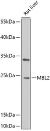 Anti-MBL2 antibody used in Western Blot (WB). GTX54368