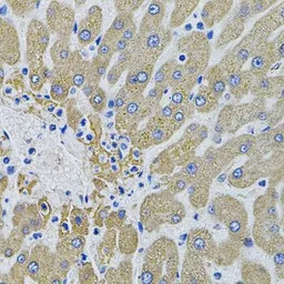 Anti-MBL2 antibody used in IHC (Paraffin sections) (IHC-P). GTX54368