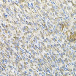 Anti-MBL2 antibody used in IHC (Paraffin sections) (IHC-P). GTX54368