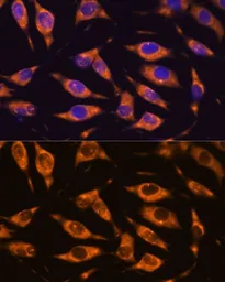 Anti-MMP25 antibody used in Immunocytochemistry/ Immunofluorescence (ICC/IF). GTX54370