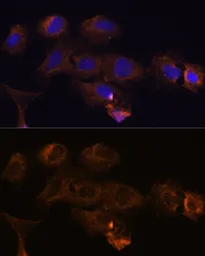 Anti-MMP25 antibody used in Immunocytochemistry/ Immunofluorescence (ICC/IF). GTX54370