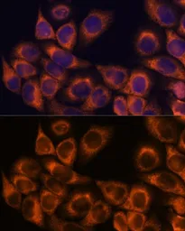 Anti-MMP25 antibody used in Immunocytochemistry/ Immunofluorescence (ICC/IF). GTX54370
