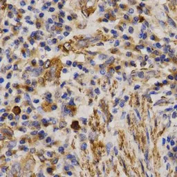 Anti-MMP25 antibody used in IHC (Paraffin sections) (IHC-P). GTX54370