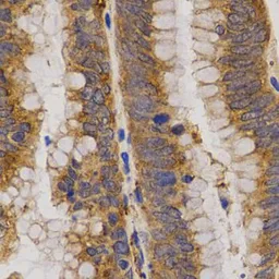 Anti-MMP25 antibody used in IHC (Paraffin sections) (IHC-P). GTX54370