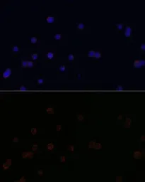 Anti-CD18 antibody used in Immunocytochemistry/ Immunofluorescence (ICC/IF). GTX54372