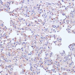 Anti-CD18 antibody used in IHC (Paraffin sections) (IHC-P). GTX54372