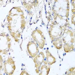 Anti-Kv4.2 antibody used in IHC (Paraffin sections) (IHC-P). GTX54373
