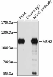 Anti-MSH2 antibody used in Immunoprecipitation (IP). GTX54377