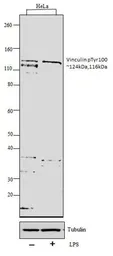 Anti-Vinculin (phospho Tyr100) antibody used in Western Blot (WB). GTX54517
