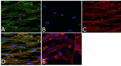 Anti-Vinculin (phospho Tyr1065) antibody used in Immunocytochemistry/ Immunofluorescence (ICC/IF). GTX54518