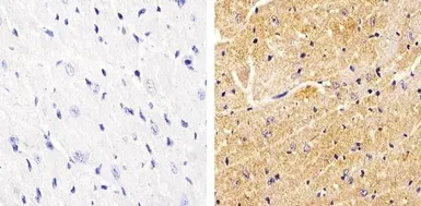 Anti-Vinculin (phospho Tyr822) antibody used in IHC (Paraffin sections) (IHC-P). GTX54519