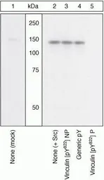Anti-Vinculin (phospho Tyr822) antibody used in Western Blot (WB). GTX54519