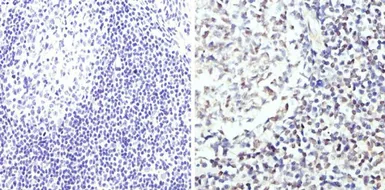 Anti-GATA3 antibody used in IHC (Paraffin sections) (IHC-P). GTX54527