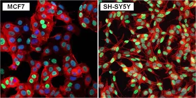 Anti-GATA3 antibody used in Immunocytochemistry/ Immunofluorescence (ICC/IF). GTX54527
