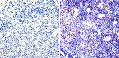 Anti-PAX5 antibody used in IHC (Paraffin sections) (IHC-P). GTX54532