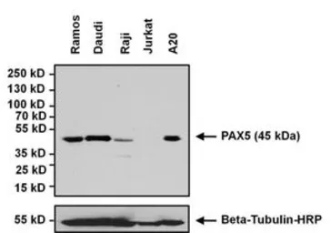 Anti-PAX5 antibody used in Western Blot (WB). GTX54532