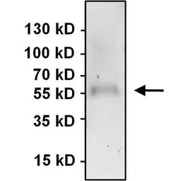 Anti-PAX7 antibody used in Immunoprecipitation (IP). GTX54533