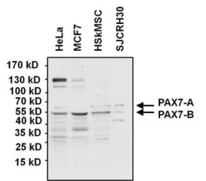 Anti-PAX7 antibody used in Western Blot (WB). GTX54533