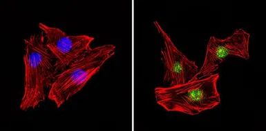 Anti-PAX7 antibody used in Immunocytochemistry/ Immunofluorescence (ICC/IF). GTX54533