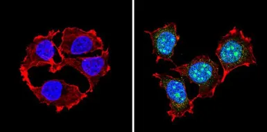 Anti-PAX7 antibody used in Immunocytochemistry/ Immunofluorescence (ICC/IF). GTX54533