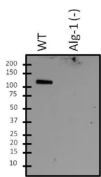 Anti-ALG1 antibody used in Western Blot (WB). GTX54538
