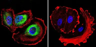 Anti-ARF6 antibody used in Immunocytochemistry/ Immunofluorescence (ICC/IF). GTX54540