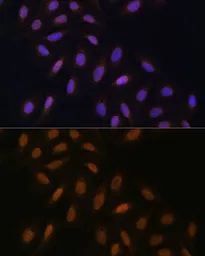 Anti-POLH antibody used in Immunocytochemistry/ Immunofluorescence (ICC/IF). GTX54545
