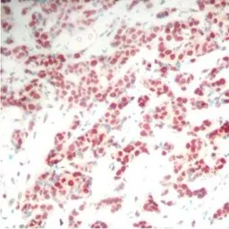 Anti-NFkB p100 (phospho Ser866) antibody used in IHC (Paraffin sections) (IHC-P). GTX54550
