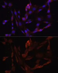 Anti-OXA1L antibody used in Immunocytochemistry/ Immunofluorescence (ICC/IF). GTX54553