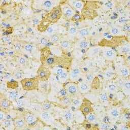Anti-OXA1L antibody used in IHC (Paraffin sections) (IHC-P). GTX54553