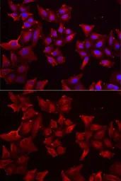 Anti-PCBD1 antibody used in Immunocytochemistry/ Immunofluorescence (ICC/IF). GTX54554