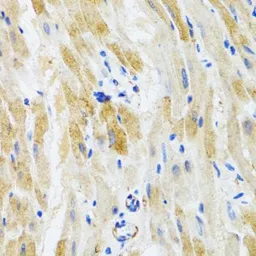 Anti-PHPT1 antibody used in IHC (Paraffin sections) (IHC-P). GTX54556