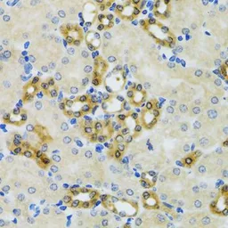 Anti-PHPT1 antibody used in IHC (Paraffin sections) (IHC-P). GTX54556