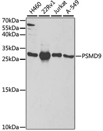 Anti-PSMD9 antibody used in Western Blot (WB). GTX54558