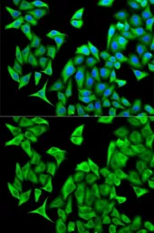 Anti-PSMD9 antibody used in Immunocytochemistry/ Immunofluorescence (ICC/IF). GTX54558