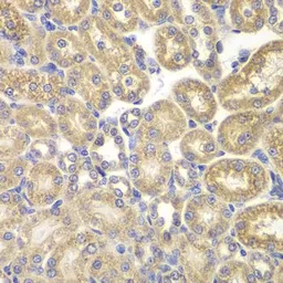 Anti-PSMD9 antibody used in IHC (Paraffin sections) (IHC-P). GTX54558