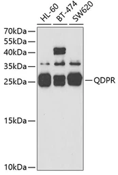 Anti-QDPR antibody used in Western Blot (WB). GTX54559