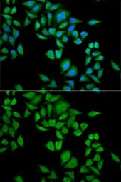 Anti-QDPR antibody used in Immunocytochemistry/ Immunofluorescence (ICC/IF). GTX54559