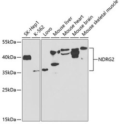 Anti-NDRG2 antibody used in Western Blot (WB). GTX54562