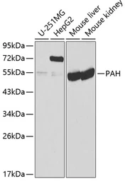 Anti-PAH antibody used in Western Blot (WB). GTX54563
