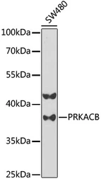 Anti-PKA beta (catalytic subunit) antibody used in Western Blot (WB). GTX54564