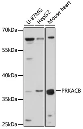 Anti-PKA beta (catalytic subunit) antibody used in Western Blot (WB). GTX54564