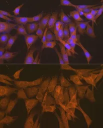 Anti-PKA beta (catalytic subunit) antibody used in Immunocytochemistry/ Immunofluorescence (ICC/IF). GTX54564