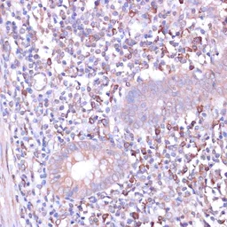 Anti-PKA beta (catalytic subunit) antibody used in IHC (Paraffin sections) (IHC-P). GTX54564