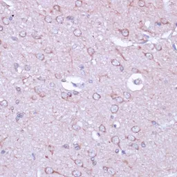 Anti-PKA beta (catalytic subunit) antibody used in IHC (Paraffin sections) (IHC-P). GTX54564