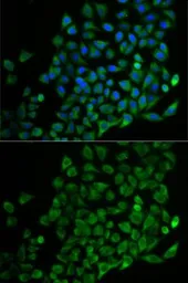 Anti-Nudel antibody used in Immunocytochemistry/ Immunofluorescence (ICC/IF). GTX54566