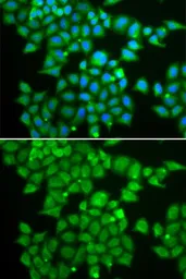 Anti-PDE1B antibody used in Immunocytochemistry/ Immunofluorescence (ICC/IF). GTX54568
