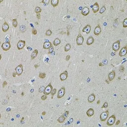 Anti-PDE1B antibody used in IHC (Paraffin sections) (IHC-P). GTX54568
